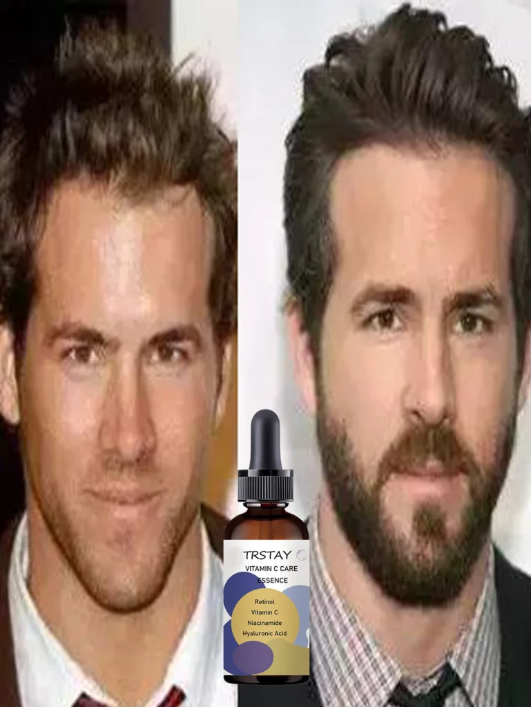 Top Beard Oils for Smoother, Healthier Facial Hair and Enhanced Style