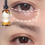 Effective Eye Hydrating Oil to Reduce Dark Circles and Puffy Eyes Naturally