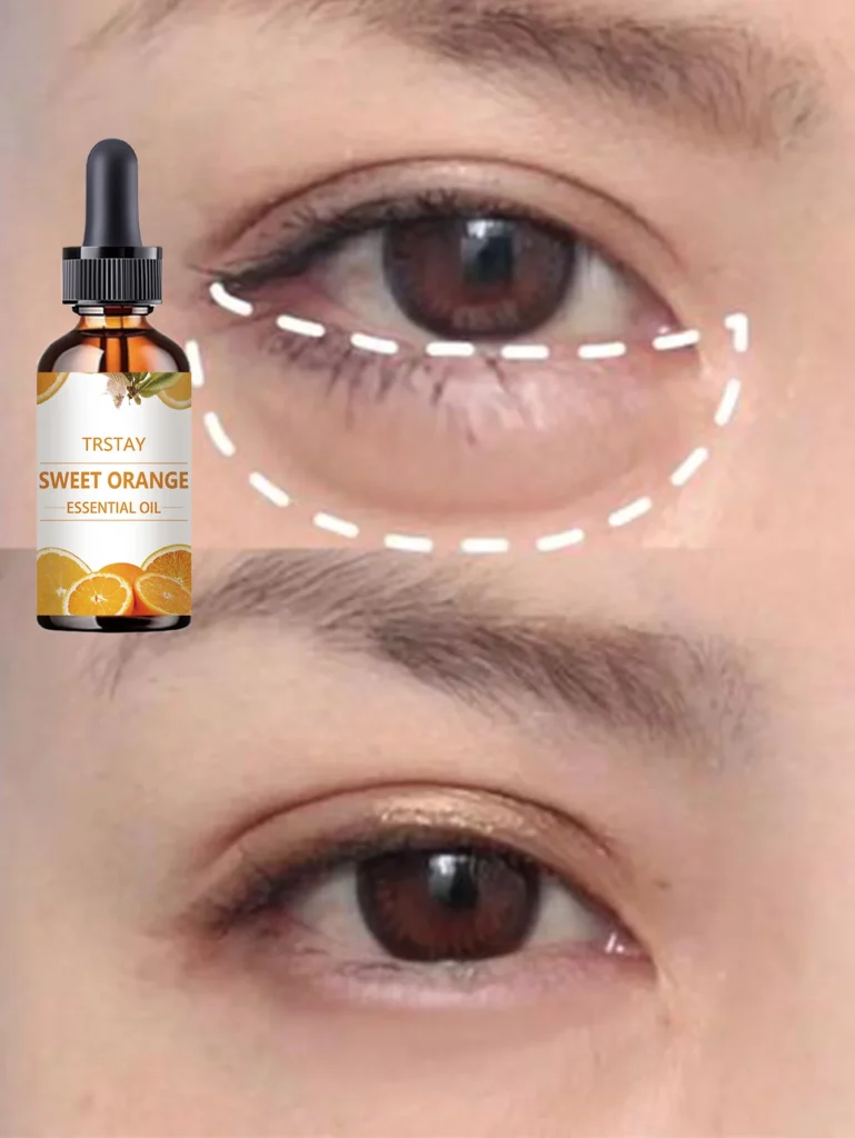 Effective Eye Hydrating Oil to Reduce Dark Circles and Puffy Eyes Naturally