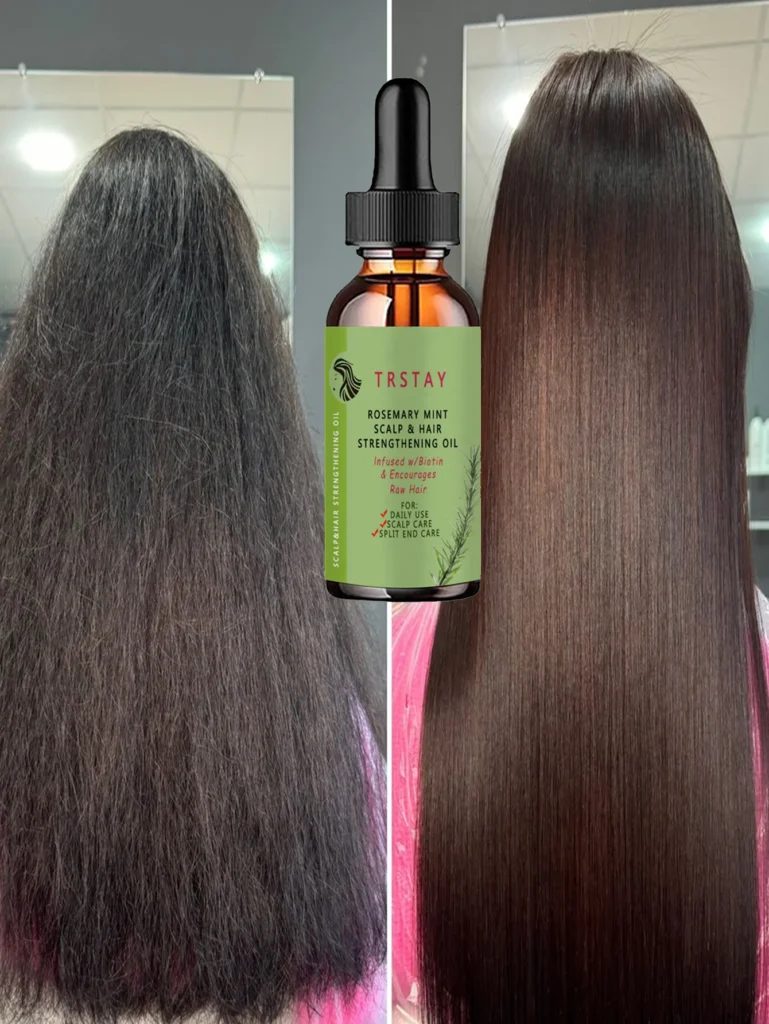 Effective Anti-Shedding Oil to Boost Hair Growth and Strengthen Roots