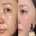 Top Benefits of This Gentle Facial Oil for Hydrating Sensitive Skin Naturally