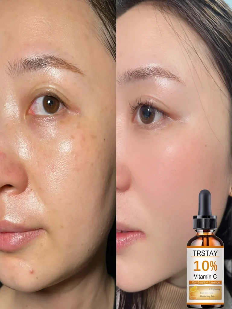 Top Benefits of This Gentle Facial Oil for Hydrating Sensitive Skin Naturally