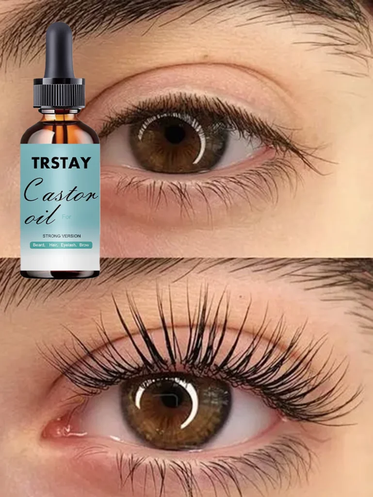 Effective Vitamin E Eye Oil Review for Reducing Dark Circles and Wrinkles