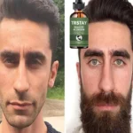 Top Beard Oil for Men to Boost Growth and Eliminate Frizz Effortlessly